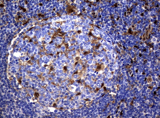 TYMP Antibody in Immunohistochemistry (Paraffin) (IHC (P))