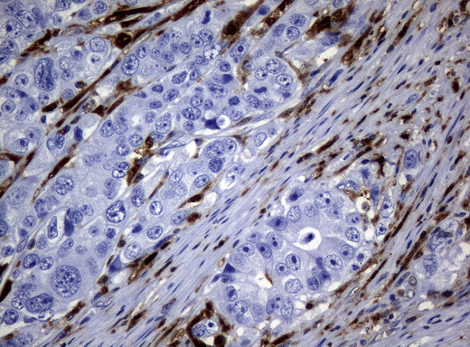 TYMP Antibody in Immunohistochemistry (Paraffin) (IHC (P))