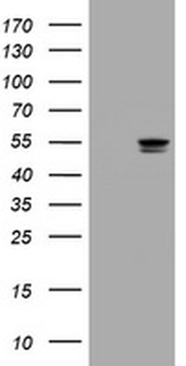 TYMP Antibody in Western Blot (WB)