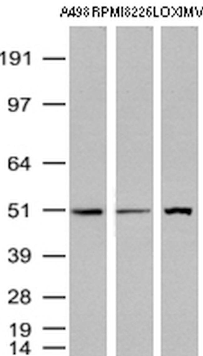 TYMP Antibody in Western Blot (WB)