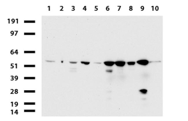 TYMP Antibody in Western Blot (WB)