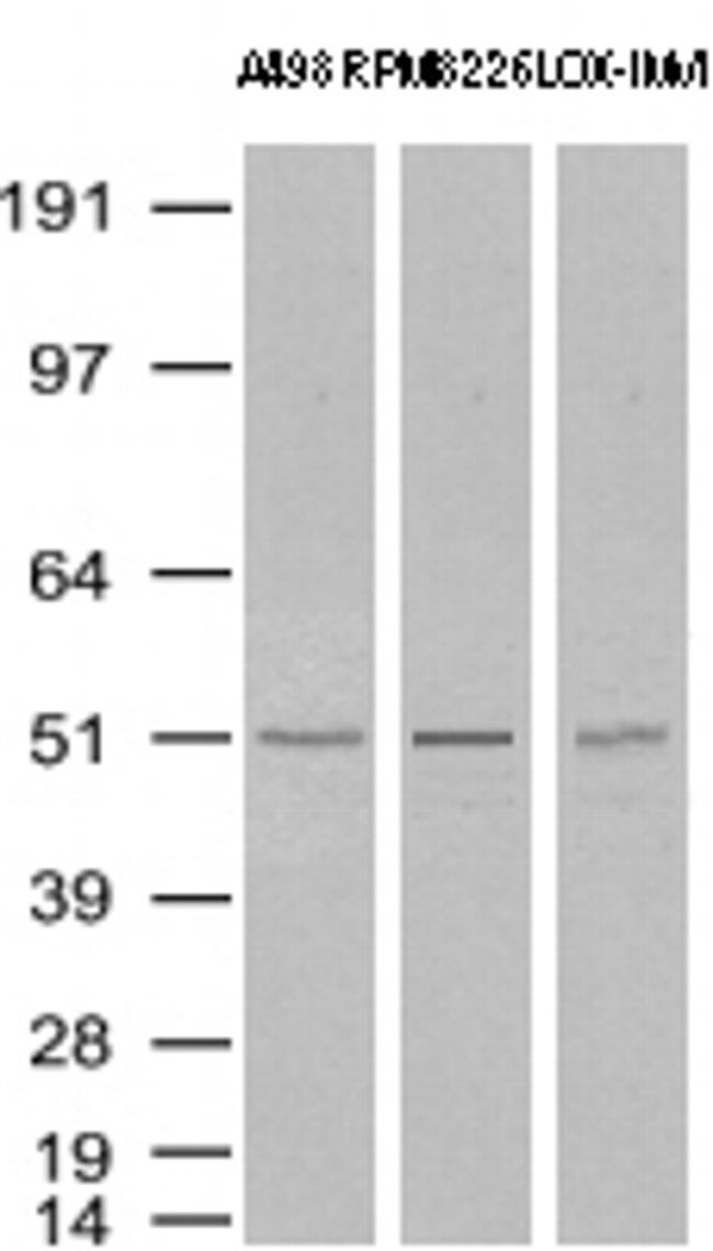 TYMP Antibody in Western Blot (WB)