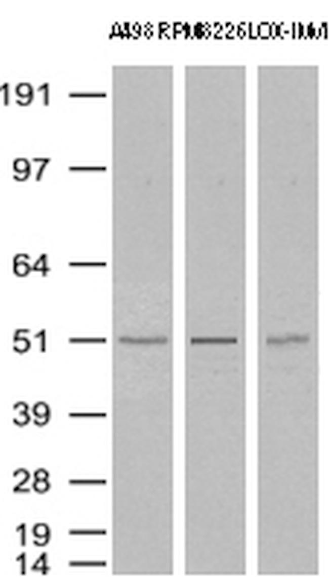 TYMP Antibody in Western Blot (WB)