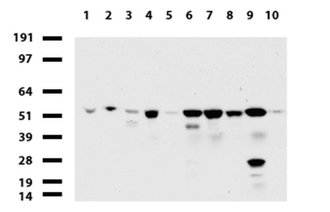 TYMP Antibody in Western Blot (WB)