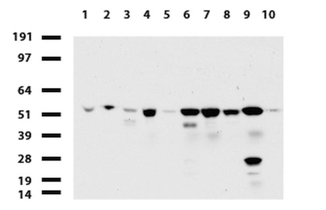 TYMP Antibody in Western Blot (WB)