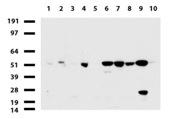 TYMP Antibody in Western Blot (WB)