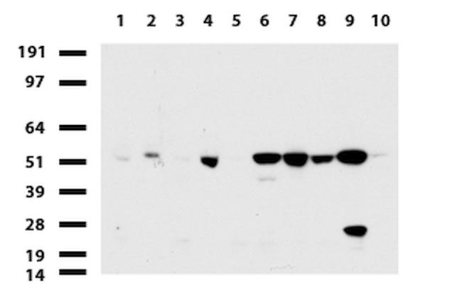 TYMP Antibody in Western Blot (WB)