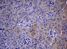 TYMS Antibody in Immunohistochemistry (Paraffin) (IHC (P))