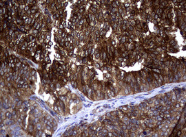 TYMS Antibody in Immunohistochemistry (Paraffin) (IHC (P))