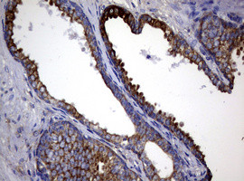 TYMS Antibody in Immunohistochemistry (Paraffin) (IHC (P))