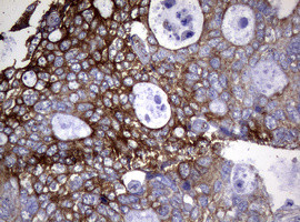 TYMS Antibody in Immunohistochemistry (Paraffin) (IHC (P))