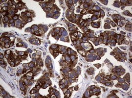 TYMS Antibody in Immunohistochemistry (Paraffin) (IHC (P))