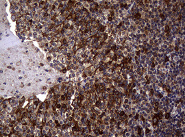 TYMS Antibody in Immunohistochemistry (Paraffin) (IHC (P))