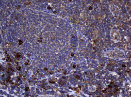 TYMS Antibody in Immunohistochemistry (Paraffin) (IHC (P))