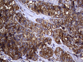 TYMS Antibody in Immunohistochemistry (Paraffin) (IHC (P))