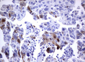 TYMS Antibody in Immunohistochemistry (Paraffin) (IHC (P))