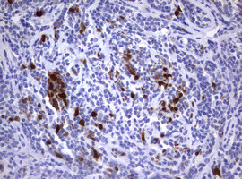 TYMS Antibody in Immunohistochemistry (Paraffin) (IHC (P))