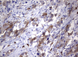 TYMS Antibody in Immunohistochemistry (Paraffin) (IHC (P))