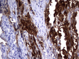 TYMS Antibody in Immunohistochemistry (Paraffin) (IHC (P))