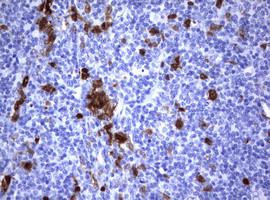 TYMS Antibody in Immunohistochemistry (Paraffin) (IHC (P))