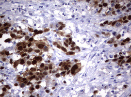 TYMS Antibody in Immunohistochemistry (Paraffin) (IHC (P))