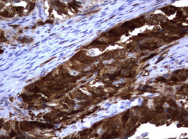 TYMS Antibody in Immunohistochemistry (Paraffin) (IHC (P))