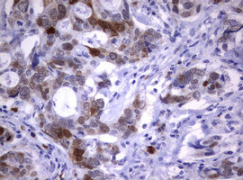 TYMS Antibody in Immunohistochemistry (Paraffin) (IHC (P))