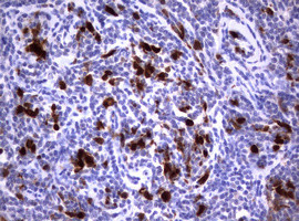 TYMS Antibody in Immunohistochemistry (Paraffin) (IHC (P))