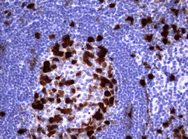 TYMS Antibody in Immunohistochemistry (Paraffin) (IHC (P))