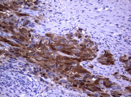 TYMS Antibody in Immunohistochemistry (Paraffin) (IHC (P))