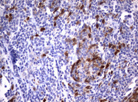 TYMS Antibody in Immunohistochemistry (Paraffin) (IHC (P))