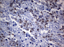 TYMS Antibody in Immunohistochemistry (Paraffin) (IHC (P))