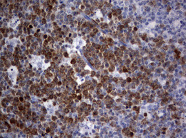 TYMS Antibody in Immunohistochemistry (Paraffin) (IHC (P))