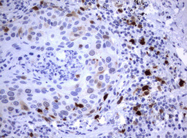 TYMS Antibody in Immunohistochemistry (Paraffin) (IHC (P))