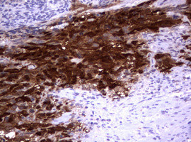 TYMS Antibody in Immunohistochemistry (Paraffin) (IHC (P))