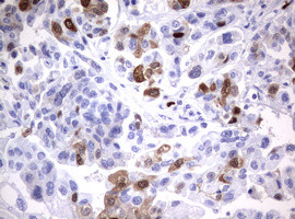 TYMS Antibody in Immunohistochemistry (Paraffin) (IHC (P))