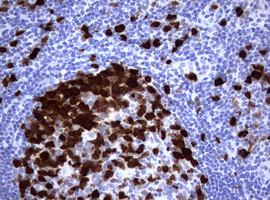 TYMS Antibody in Immunohistochemistry (Paraffin) (IHC (P))