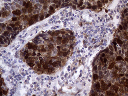 TYMS Antibody in Immunohistochemistry (Paraffin) (IHC (P))