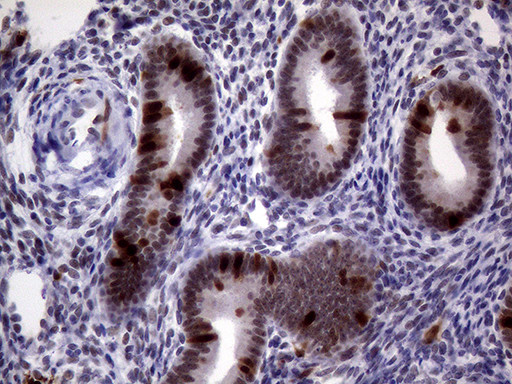 TYMS Antibody in Immunohistochemistry (Paraffin) (IHC (P))