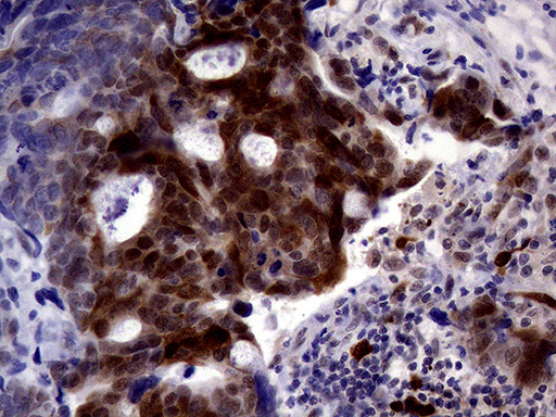 TYMS Antibody in Immunohistochemistry (Paraffin) (IHC (P))