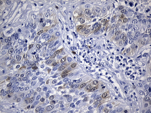 TYMS Antibody in Immunohistochemistry (Paraffin) (IHC (P))