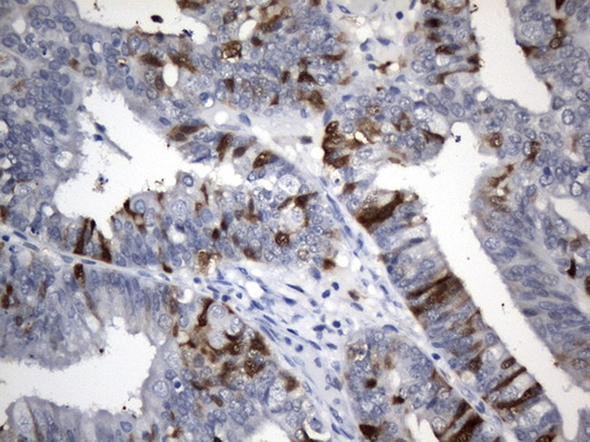 TYMS Antibody in Immunohistochemistry (Paraffin) (IHC (P))