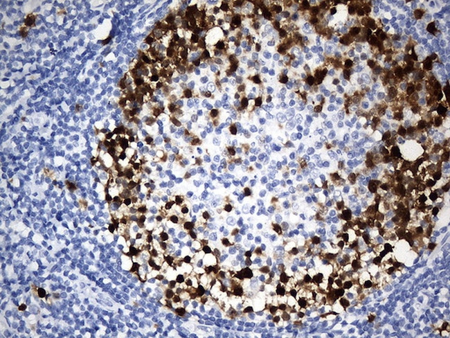 TYMS Antibody in Immunohistochemistry (Paraffin) (IHC (P))