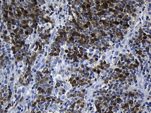 TYMS Antibody in Immunohistochemistry (Paraffin) (IHC (P))