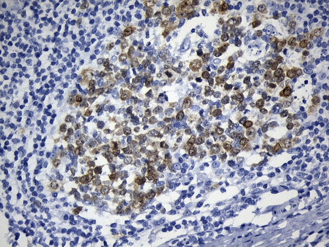 TYMS Antibody in Immunohistochemistry (Paraffin) (IHC (P))