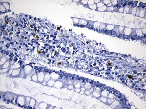 TYMS Antibody in Immunohistochemistry (Paraffin) (IHC (P))