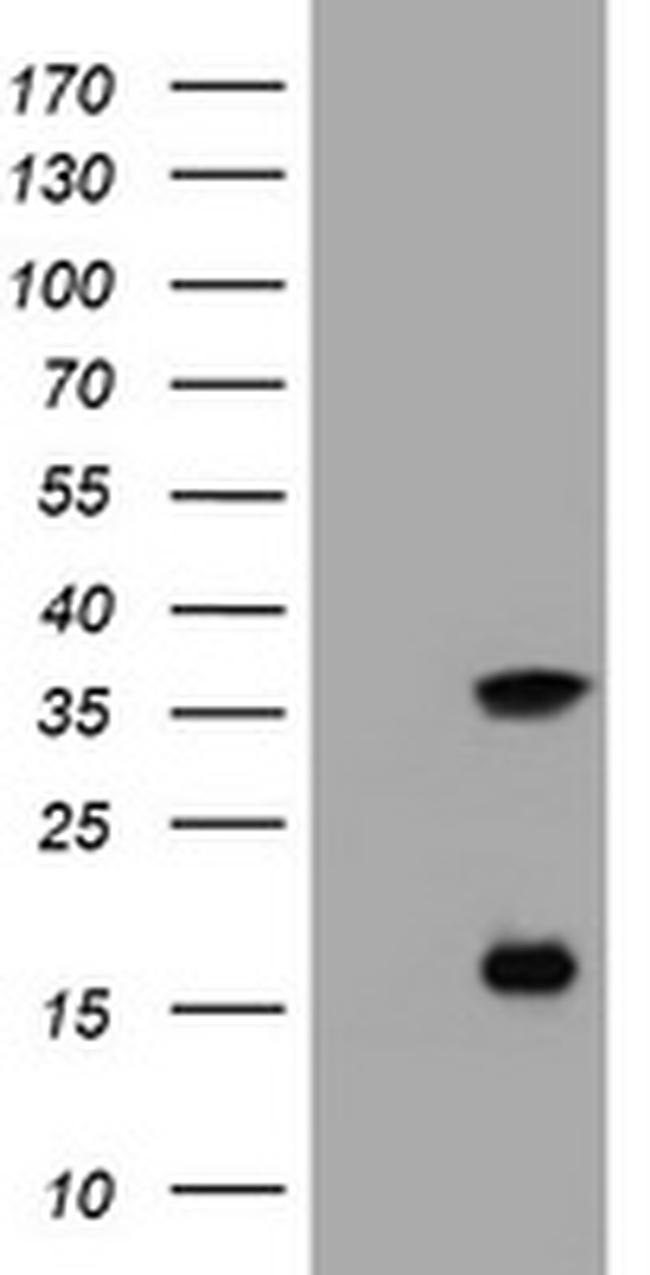 TYMS Antibody in Western Blot (WB)