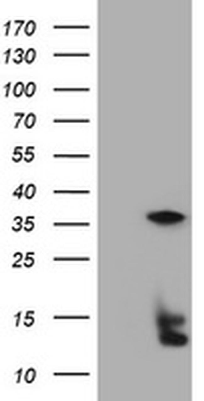 TYMS Antibody in Western Blot (WB)