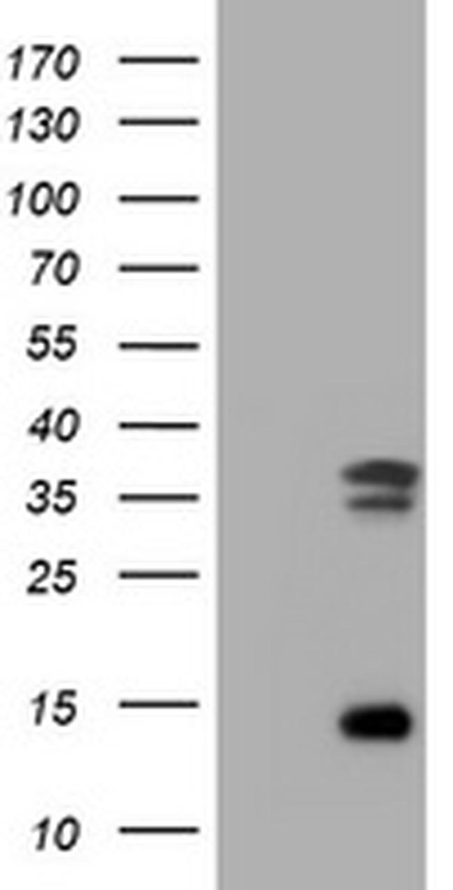 TYMS Antibody in Western Blot (WB)