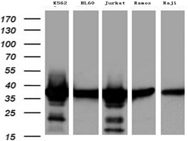 TYMS Antibody in Western Blot (WB)